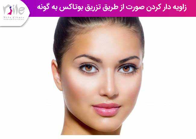 زاویه دار کردن صورت از طریق تزریق بوتاکس به گونه