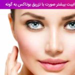 جذابیت بیشتر صورت با تزریق بوتاکس به گونه