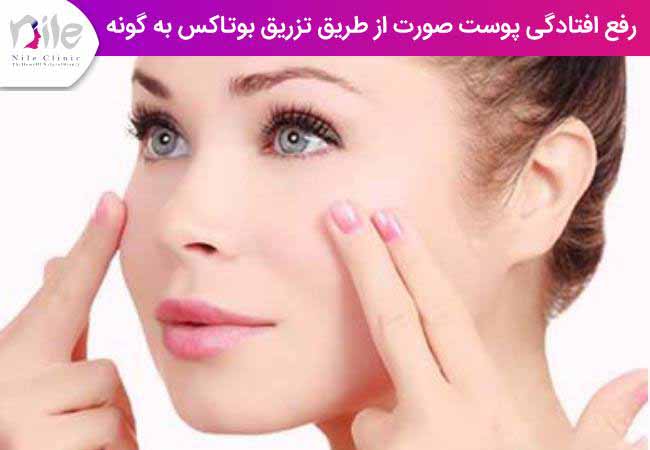رفع افتادگی پوست صورت از طریق تزریق بوتاکس به گونه