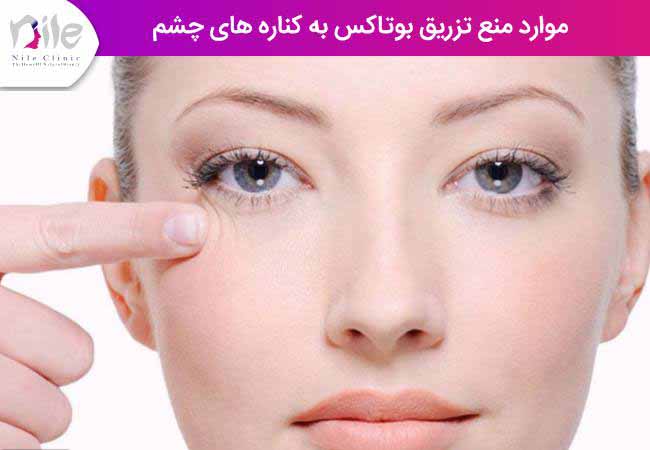 موارد منع تزریق بوتاکس به کناره های چشم