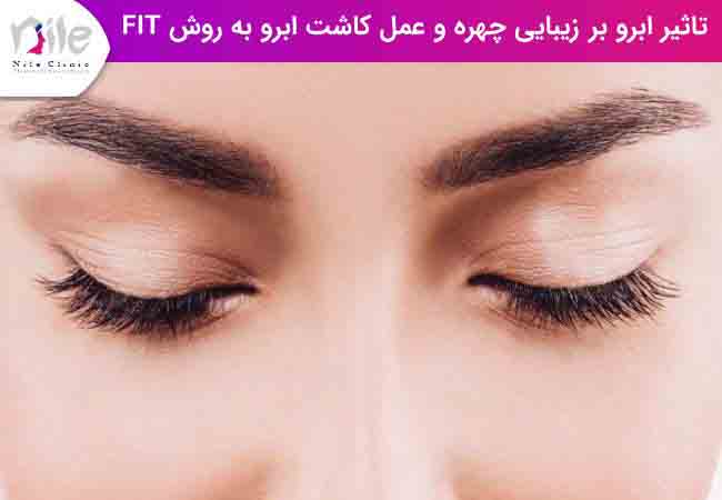 تاثیر ابرو بر زیبایی چهره و عمل کاشت ابرو به روش fit