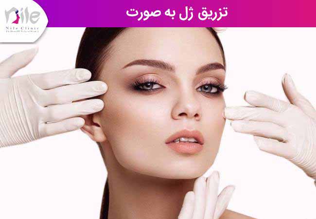 تزریق ژل به صورت