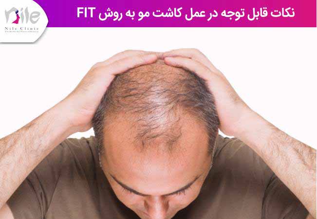 نکات قابل توجه در عمل کاشت مو به روش fit