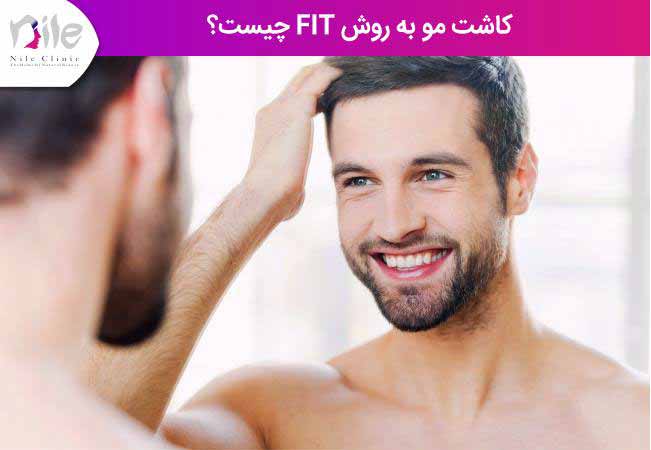 کاشت مو به روش fit چیست ؟