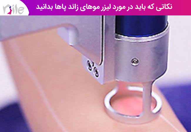نکاتی که باید در مورد لیزر موهای زائد پاها بدانید
