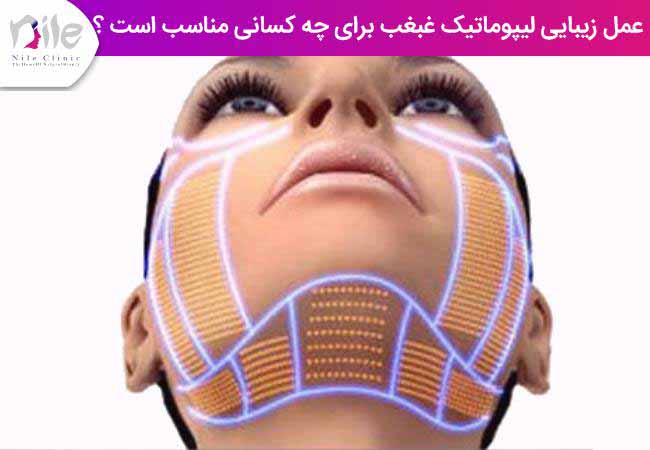 عمل زیبایی لیپوماتیک غبغب برای چه کسانی مناسب است ؟