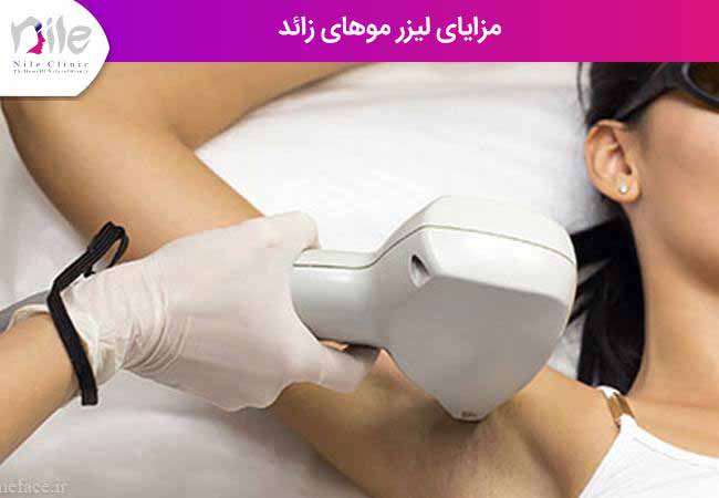 مزایای لیزر موهای زائد