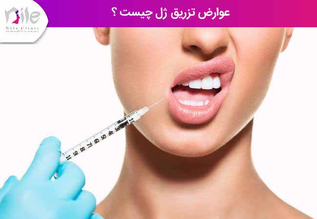 عوارض تزریق ژل چیست ؟