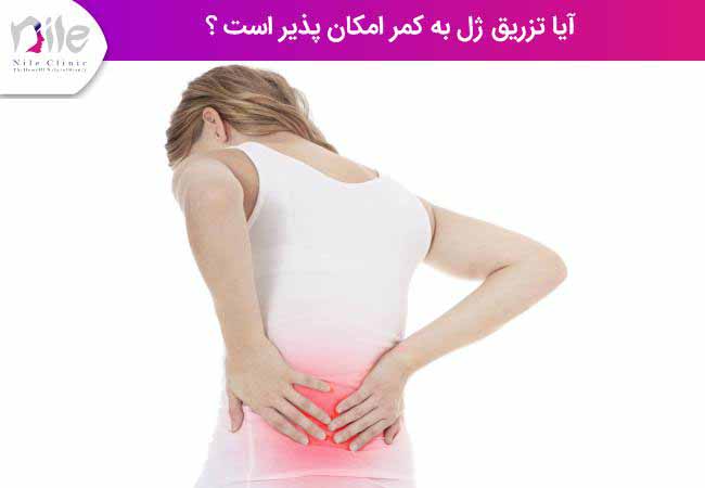 آیا تزریق ژل به کمر امکان پذیر است ؟