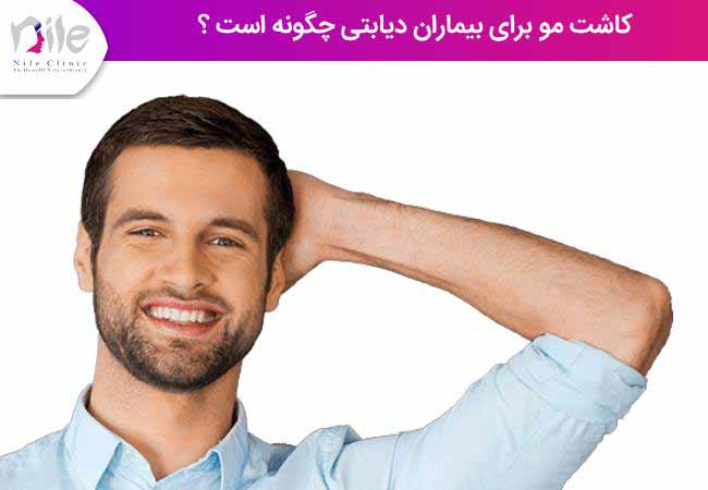 کاشت مو برای بیماران دیابتی چگونه است ؟