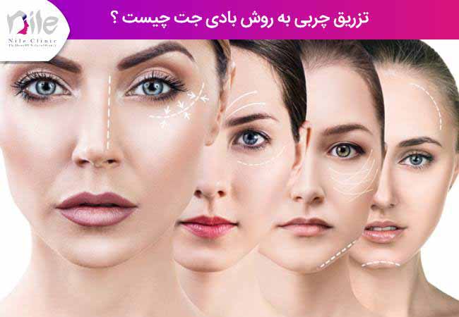 تزریق چربی به روش بادی جت چیست ؟