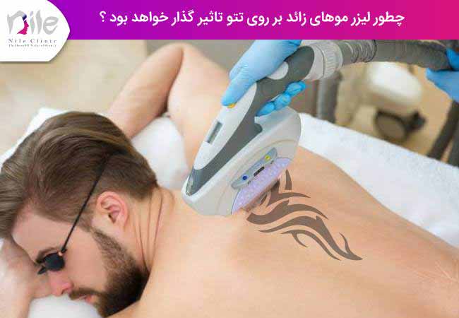 چطور لیزر موهای زائد بر روی تتو تاثیر گذار خواهد بود ؟