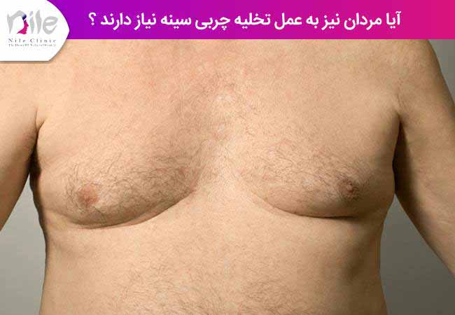 آیا مردان نیز به عمل تخلیه چربی سینه نیاز دارند ؟