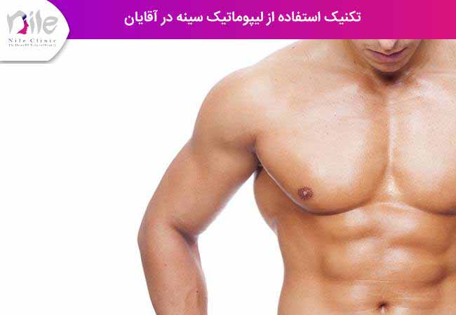 تکنیک استفاده از لیپوماتیک سینه در آقایان