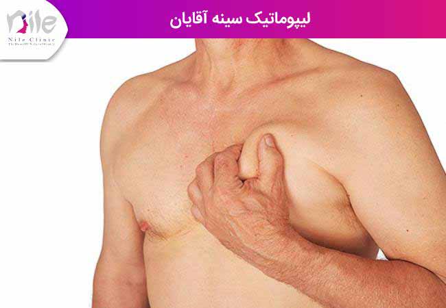 لیپوماتیک سینه آقایان