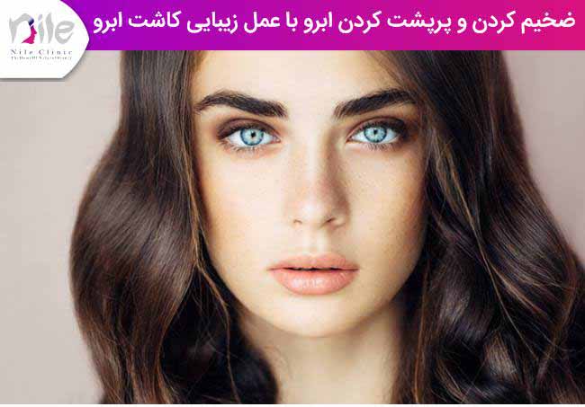 ضخیم کردن و پرپشت کردن ابرو با عمل زیبایی کاشت ابرو