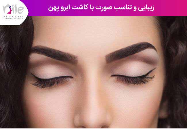 زیبایی و تناسب صورت با کاشت ابرو پهن