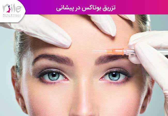 تزریق بوتاکس در پیشانی