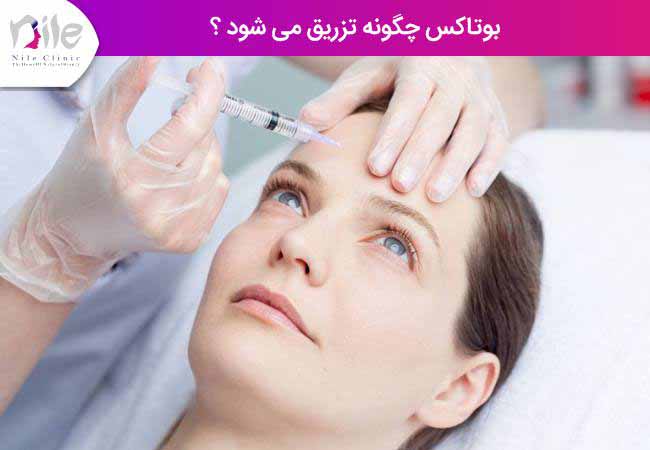 بوتاکس چگونه تزریق می شود ؟