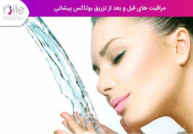 مراقبت های قبل و بعد از تزریق بوتاکس