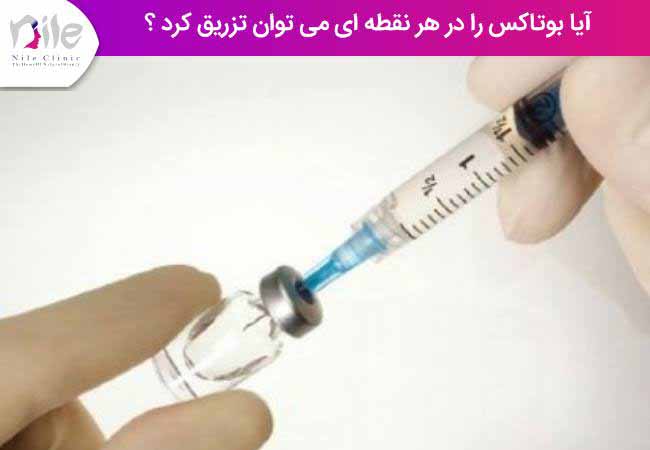 آیا بوتاکس را در هر نقطه ای می توان تزریق کرد ؟