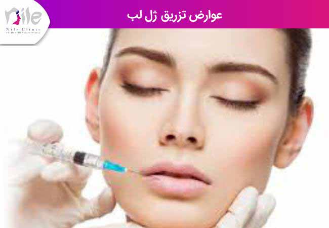 عوارض تزریق ژل لب