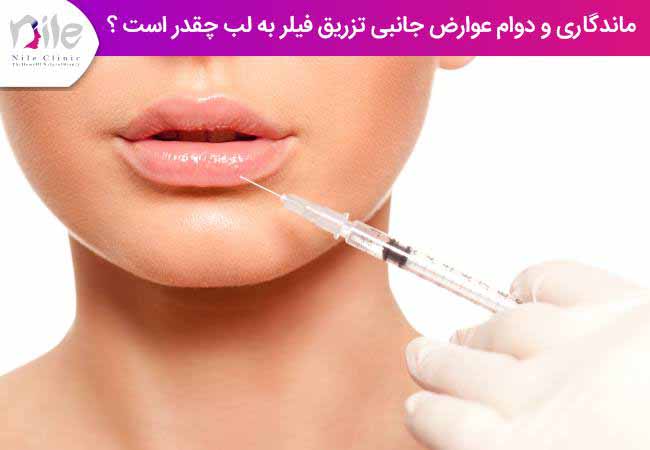 ماندگاری و دوام عوارض جانبی تزریق فیلر به لب چقدر است ؟