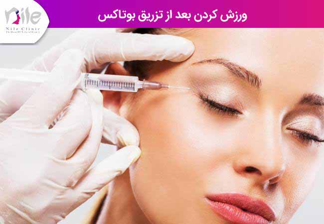 ورزش کردن بعد از تزریق بوتاکس