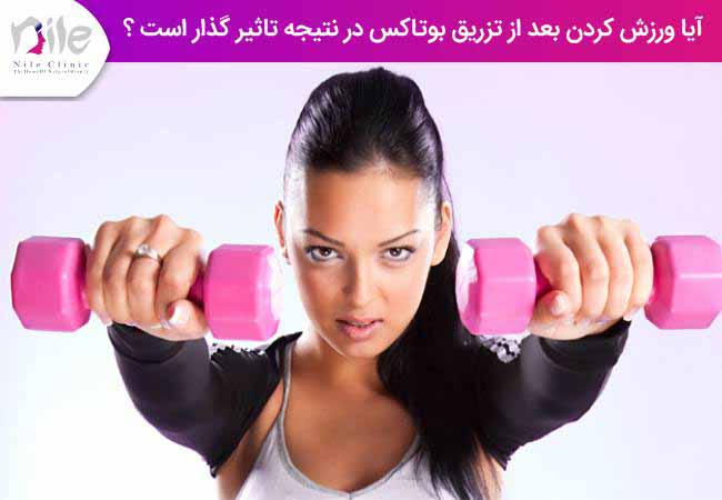 آیا ورزش کردن بعد از تزریق بوتاکس در نتیجه تاثیر گذار است ؟