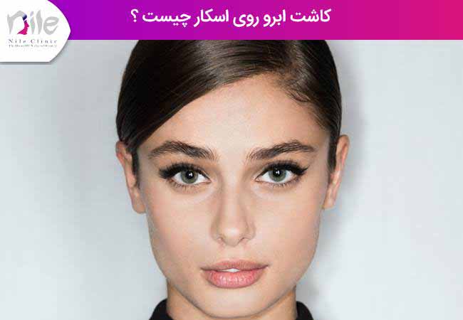 کاشت ابرو روی اسکار چیست ؟