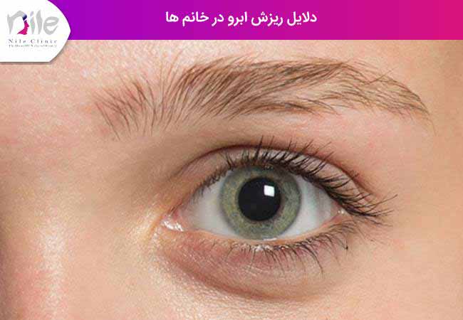 دلایل ریزش ابرو در خانم ها