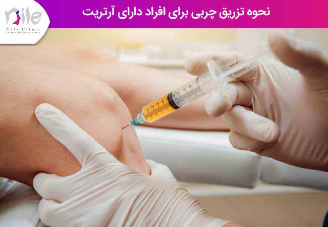 نحوه تزریق چربی برای افراد دارای آرتریت