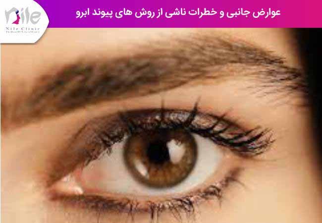 عوارض جانبی و خطرات ناشی از روش های کاشت ابرو