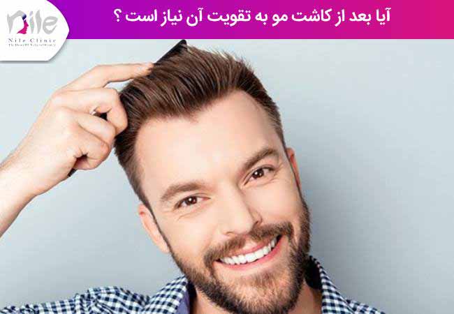 آیا بعد از کاشت مو به تقویت آن نیاز است ؟