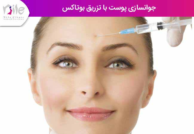 جوانسازی پوست با تزریق بوتاکس