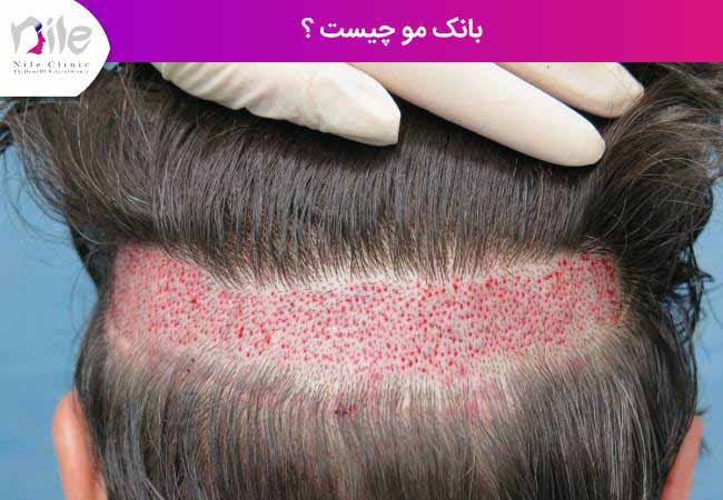 بانک مو چیست ؟