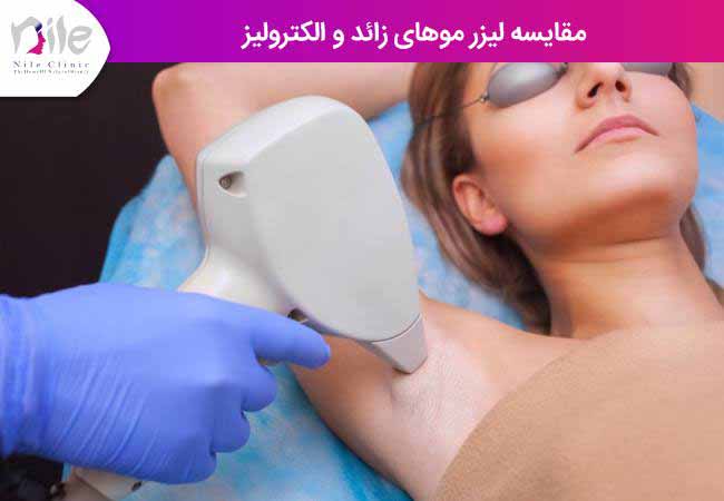مقایسه لیزر موهای زائد و الکترولیز