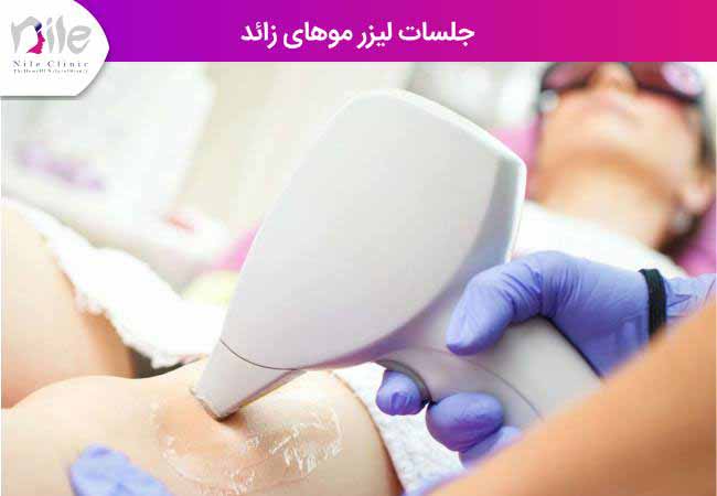 جلسات لیزر موهای زائد