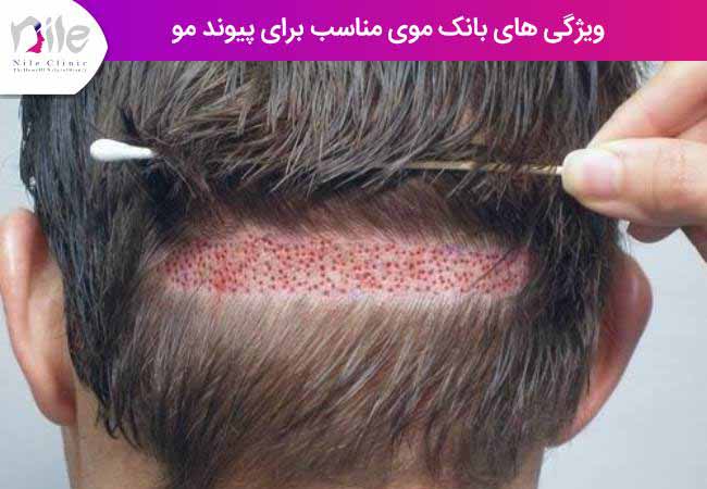 ویژگی های بانک موی مناسب برای پیوند مو
