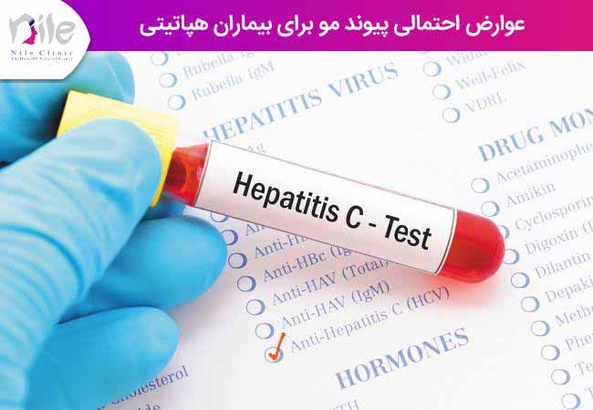 عوارض احتمالی پیوند مو برای بیماران هپاتیتی
