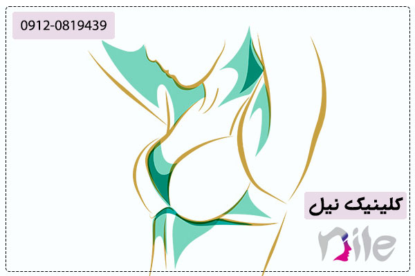 عکس از جراحی ماموپلاستی