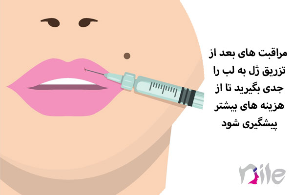 مراقبت های بعد از تزریق ژل