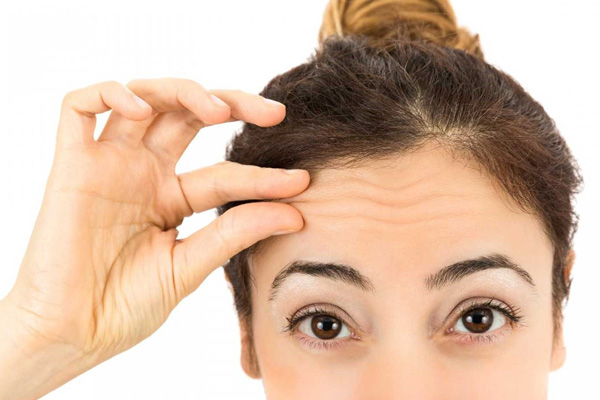 محدودیت سنی برای تزریق بوتاکس