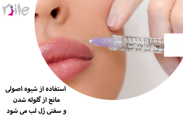 سفتی ژل لب
