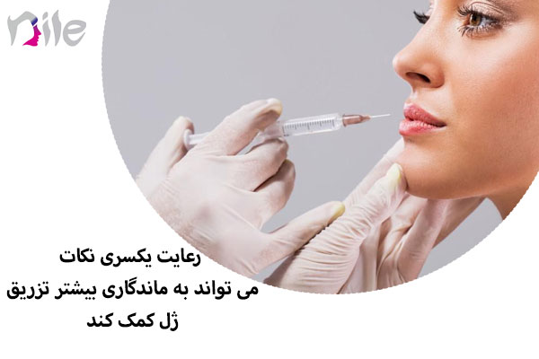 ماندگاری ژل لب
