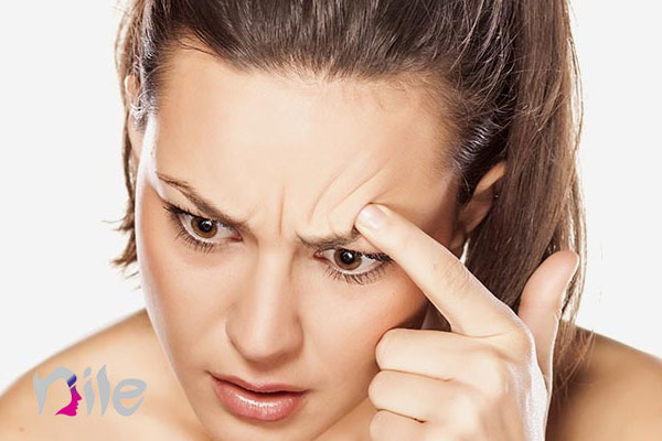 خارش ابرو بعد از کاشت