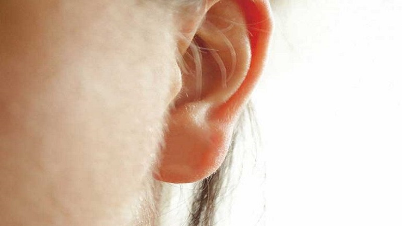 لیزر موهای کرکی صورت